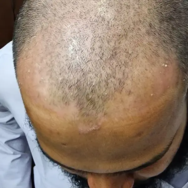 Dr Abdul Adal
