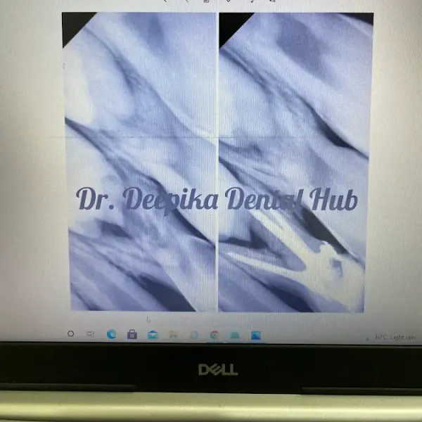 Dr. Deepika Dental Hub