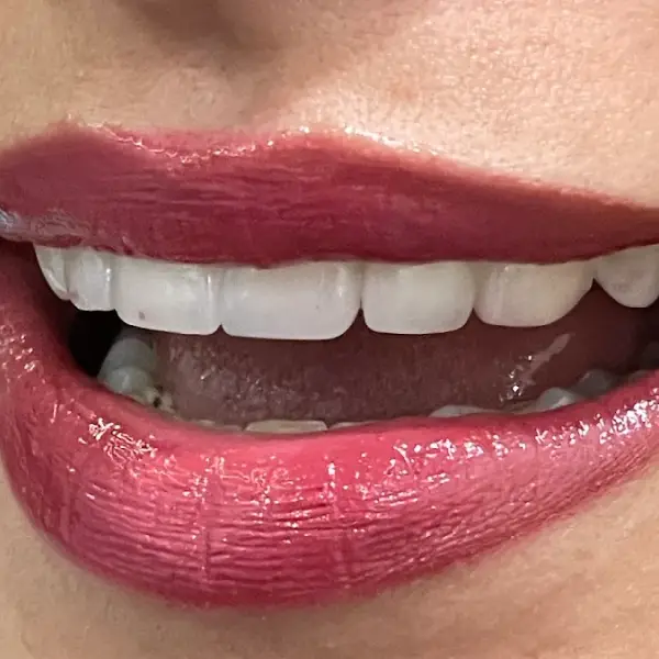 DR GREWAL'Z DENTAL SMILE STUDIO