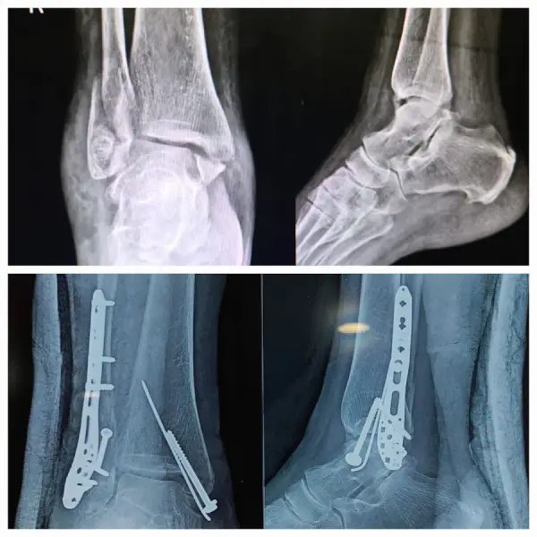 Dr Kumar Bhanu ORTHO