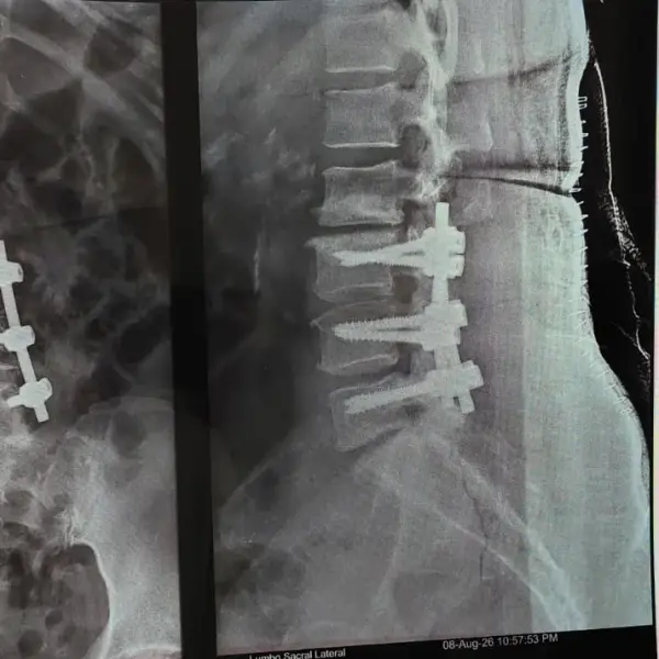 Dr Laxminadh Neuro