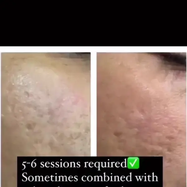 Dr Nagma's Dermed
