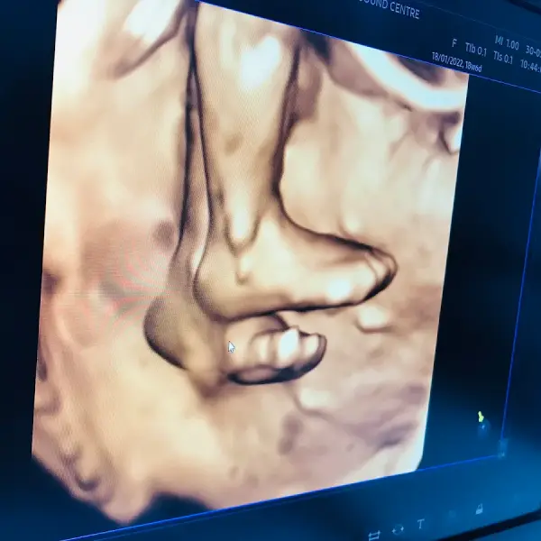 Dr Seema's Ultrasound