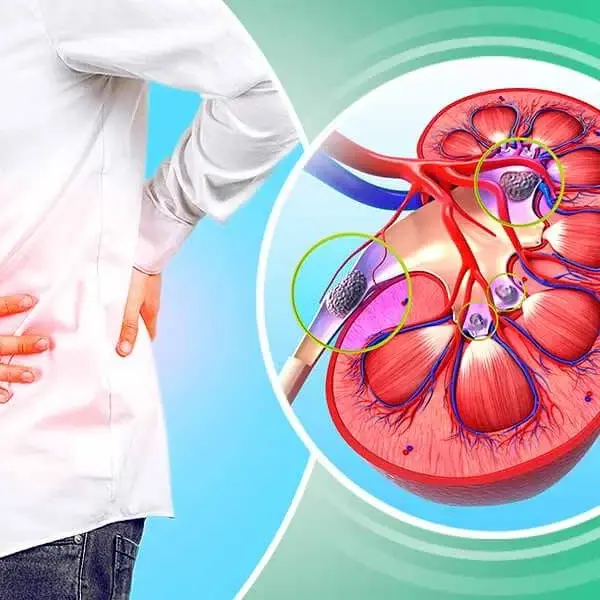 Dr Vinay Kumar Rai UroCare Noida