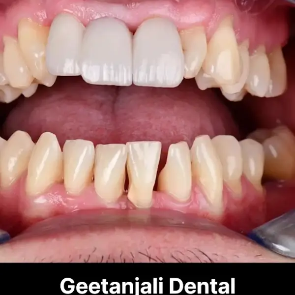 GEETANJALI DENTAL OPTIONS