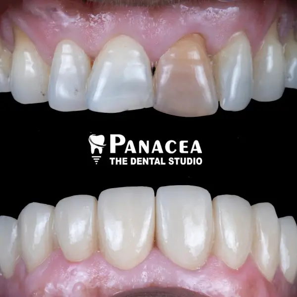 PANACEA-THE DENTAL STUDIO