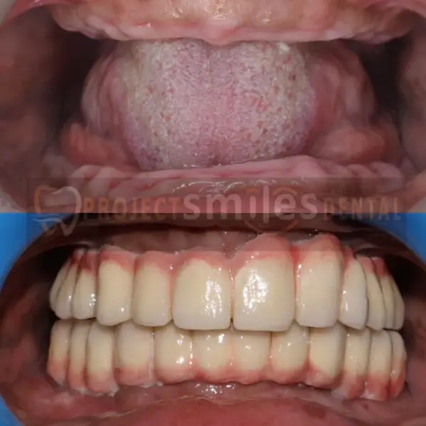 Project Smiles Dental