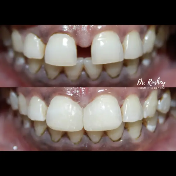 True White Dental