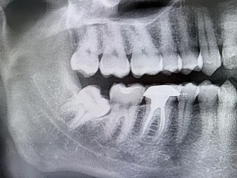 32Si Multi dental Speciality Hospital, Mohali