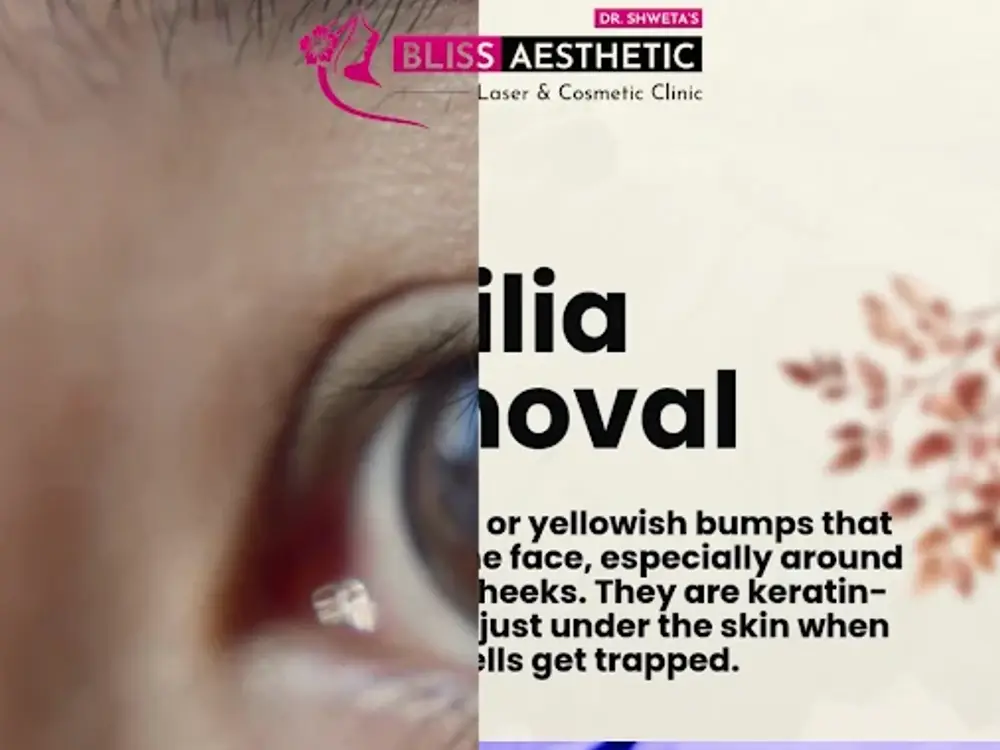 ✅Bliss Aesthetic Skin Laser Clinic, Sector 74, Mohali