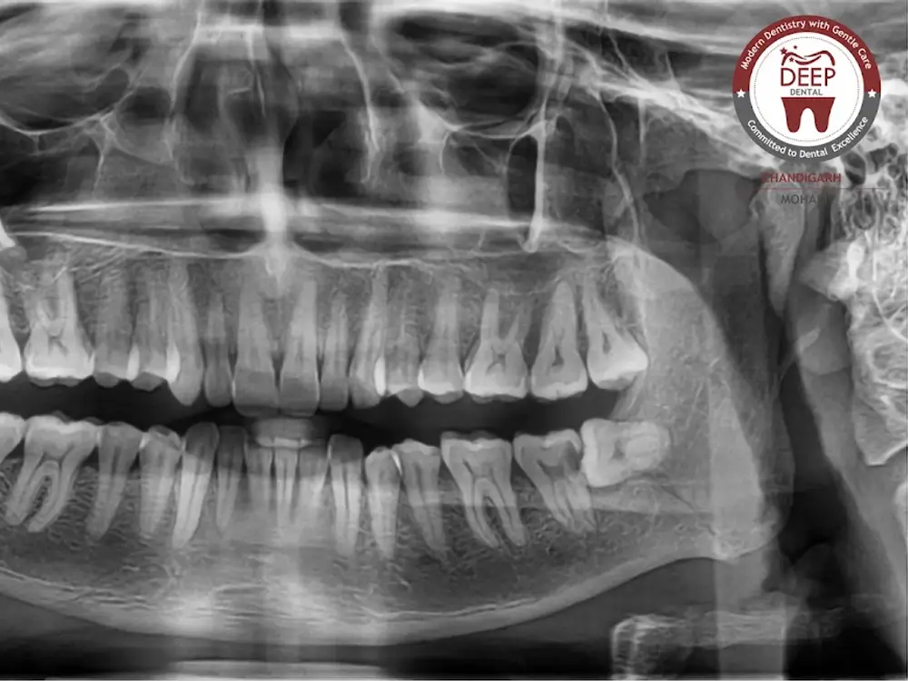 Deep Dental Clinic and OPG Centre, Sector 55, Mohali