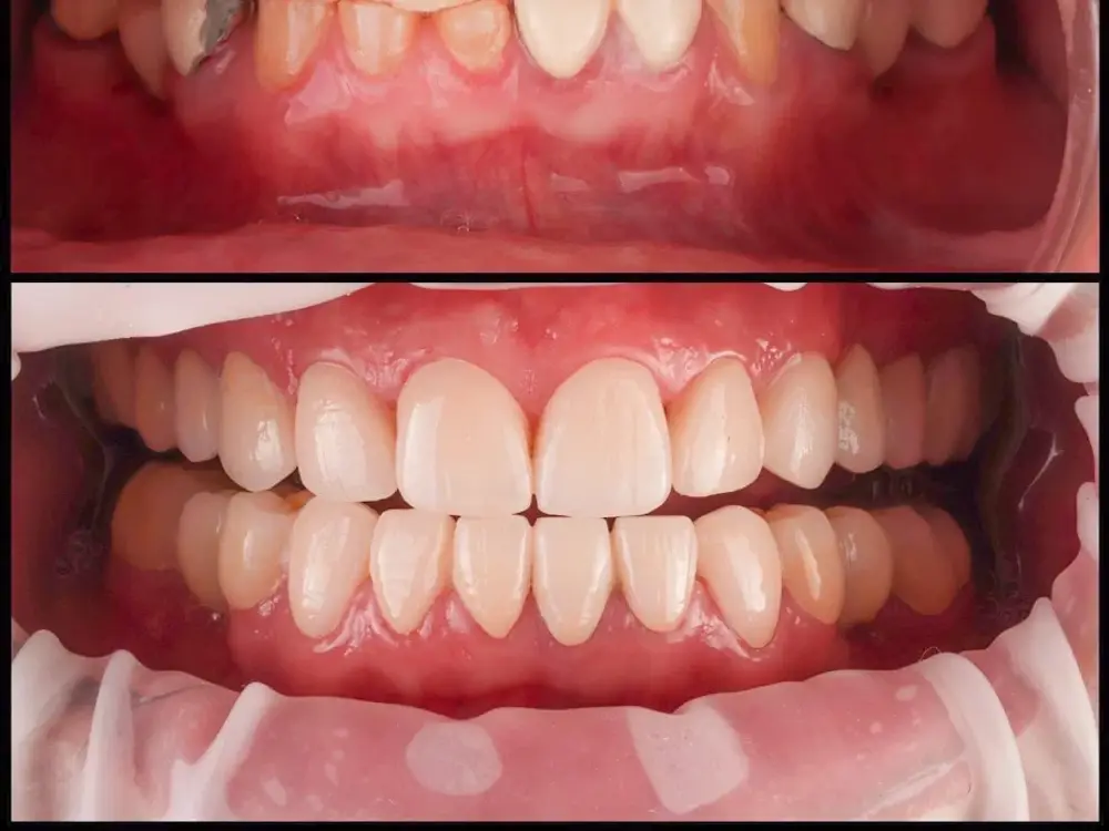 Dental SPA, Patparganj, Delhi
