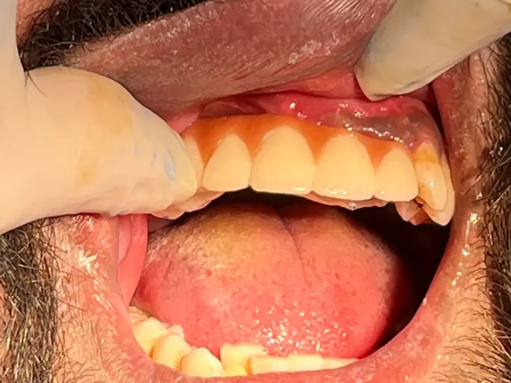 Dental Trust, Mira Road East, Thane