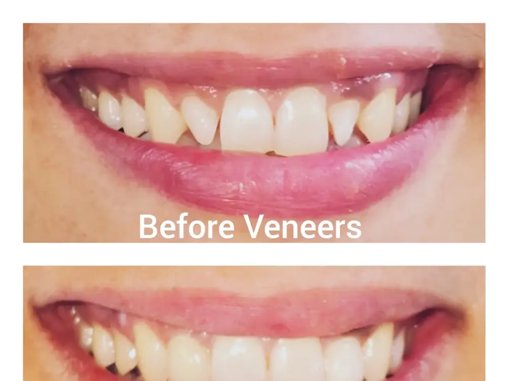 Dental Wires, Budanpur, Panchkula