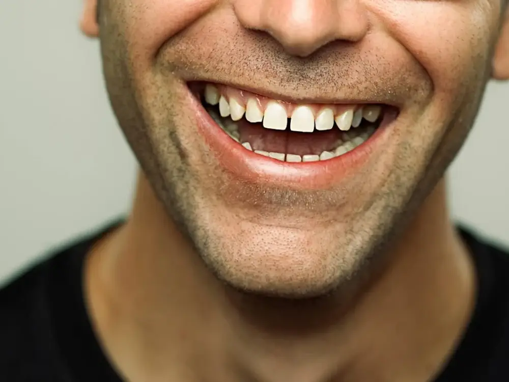 Dentist4u, Dahisar East, Mumbai
