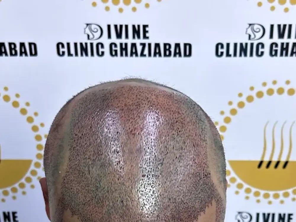 Divine Cosmetic Clinic, Vasundhara, Ghaziabad