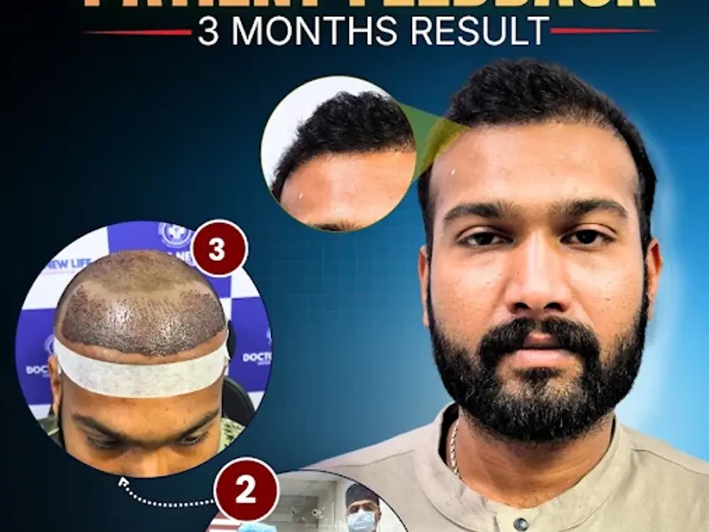 DNL Advance Hair Transplant Clinic, Sector 15, Noida