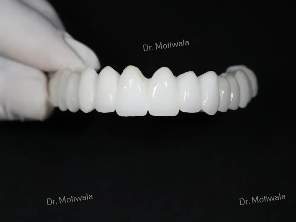 Dr. Motiwala Dental Clinic & Implant Center, Jubilee Hills, Hyderabad