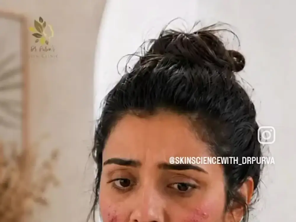 Dr. Purva's SKIN, HAIR & LASER Clinic, Sector 11, Panchkula