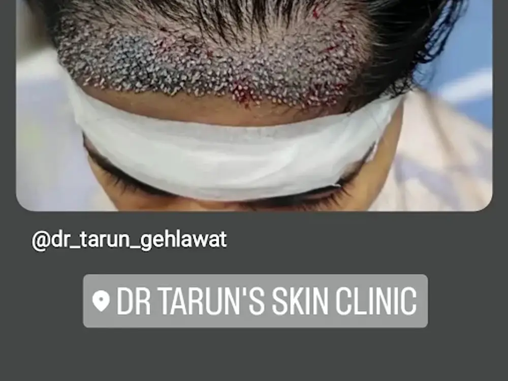 Dr Tarun's Skin Clinic, Sector 9, Panchkula