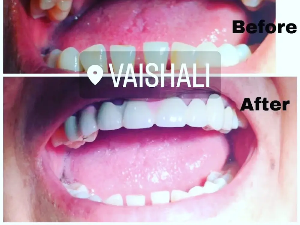 Family Dental Care Centre, Vaishali, Ghaziabad