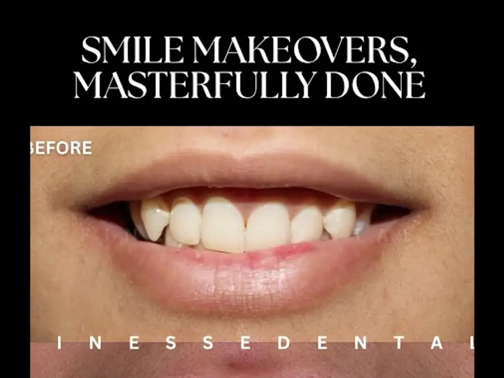 Finesse Dental Cosmetic Laser Clinic, Sector 66 A, Mohali