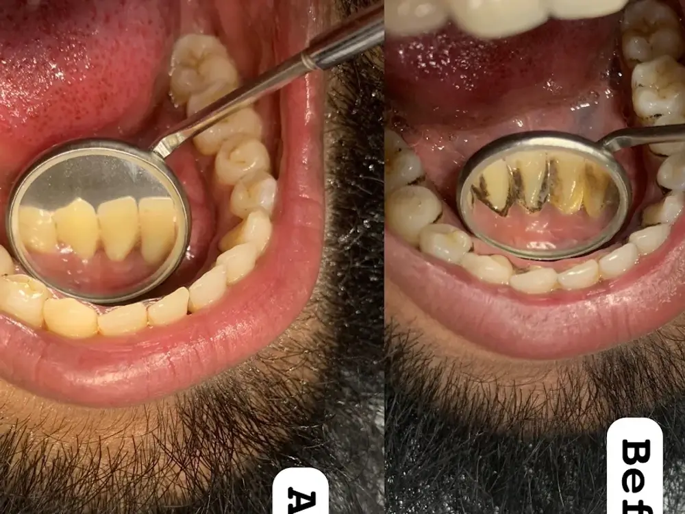 HARSHILA DENTAL CLINIC, Sector 10A, Gurgaon