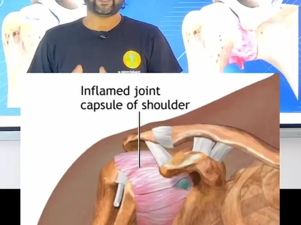 Insha Physiotherapy Center Nandgram Ghaziabad, Sewa Nagar, Ghaziabad