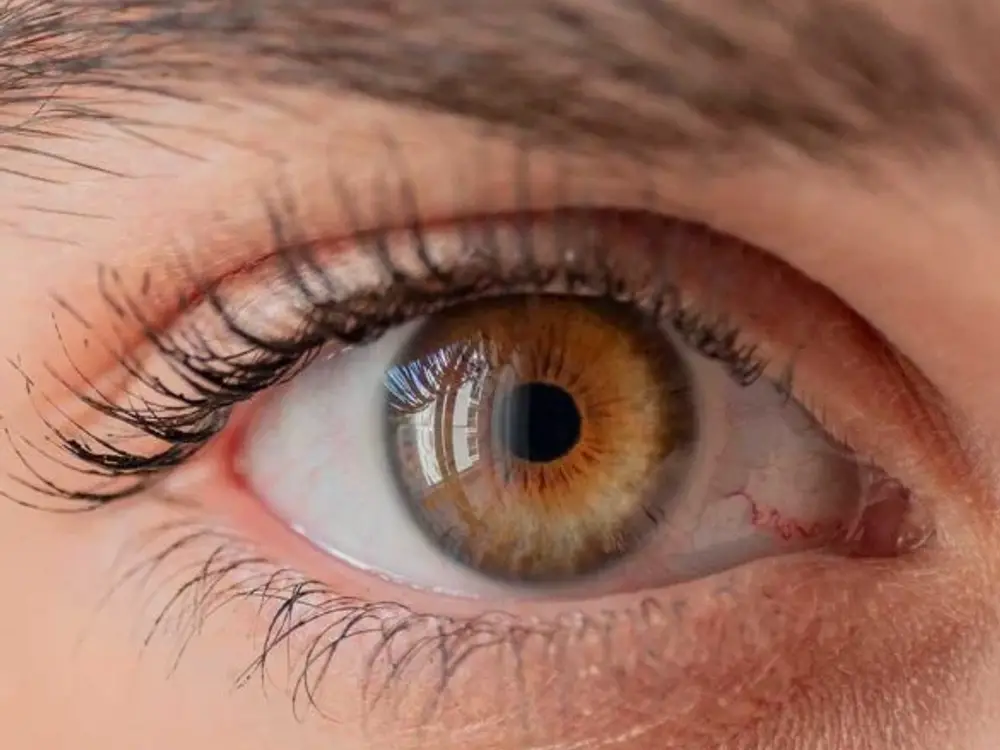 Miracle Health Care Zone Eye Clinic and Laser Clinic, Viman Nagar, Pune