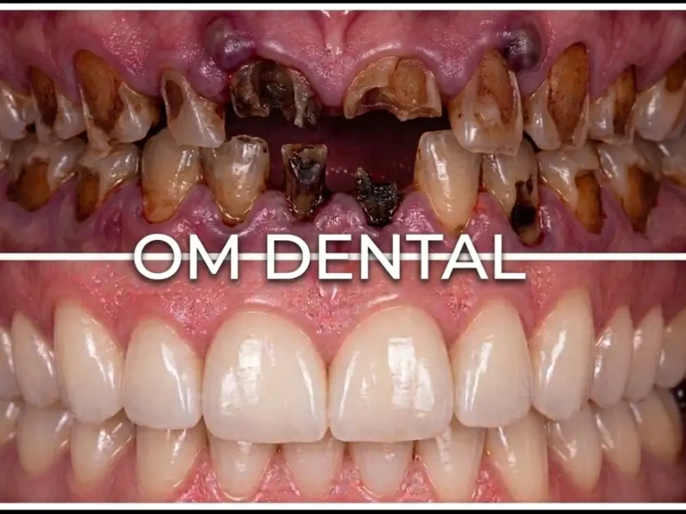 Om Dental Clinic, Sector 21C, Faridabad