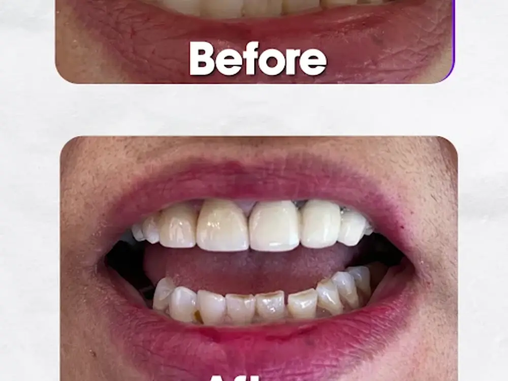 Orange Dental Clinic, Sector 22, Chandigarh