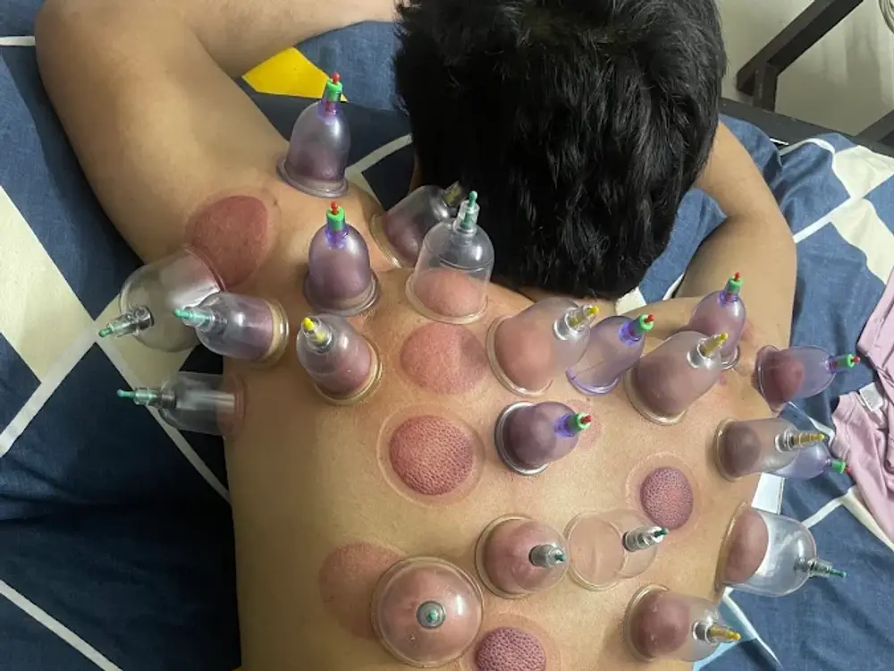 physiotherapy health experts, Sector 117, Noida