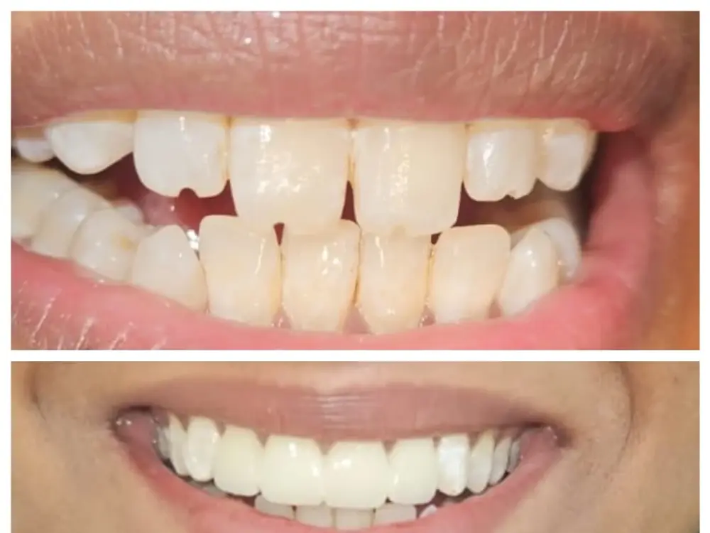 Rekha Dental Clinic Ghaziabad, Daulatpura, Ghaziabad