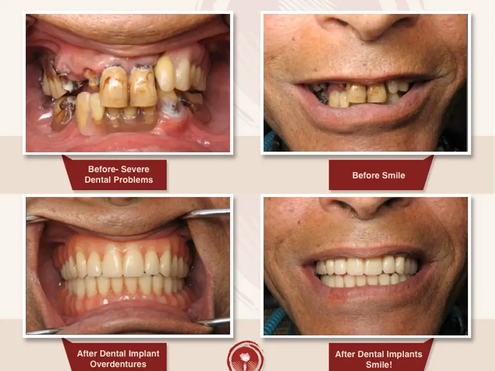 Sai Dental & Implant Clinic, Rama Krishna Puram, Delhi