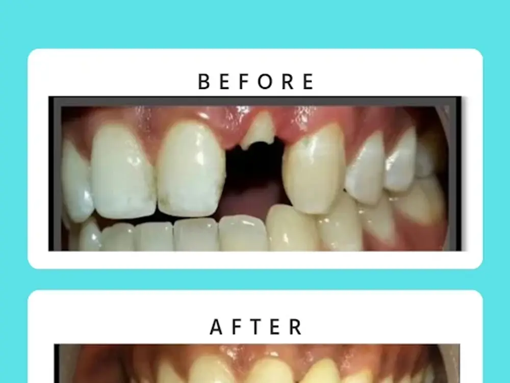 Sai Multi Speciality Dental Clinic, Baner, Baner, Pune