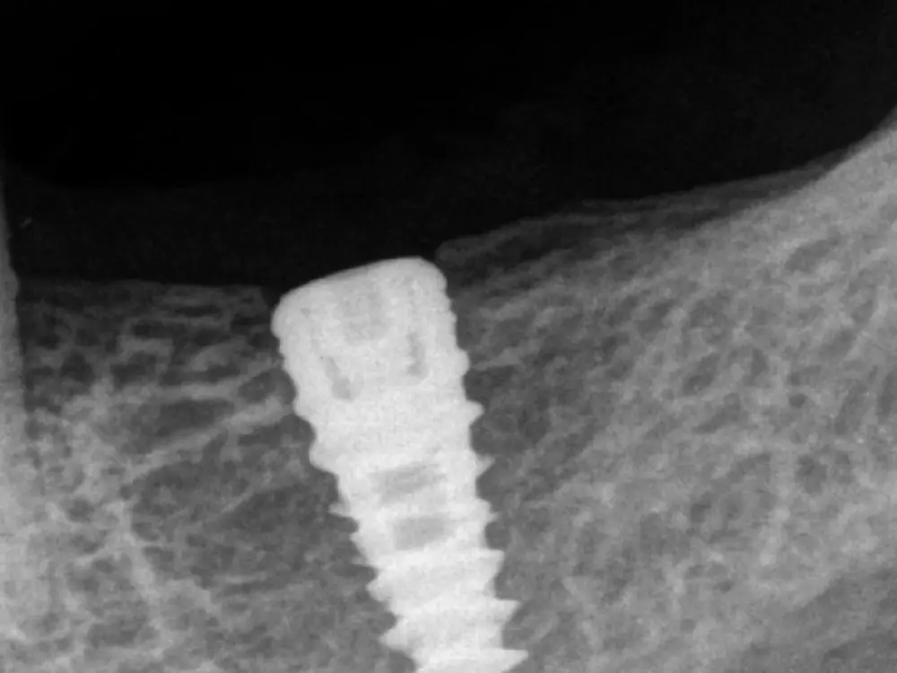 Shubham Dental & Implant Clinic by Dr. Hiren G. Mangukiya, Nikol, Ahmedabad