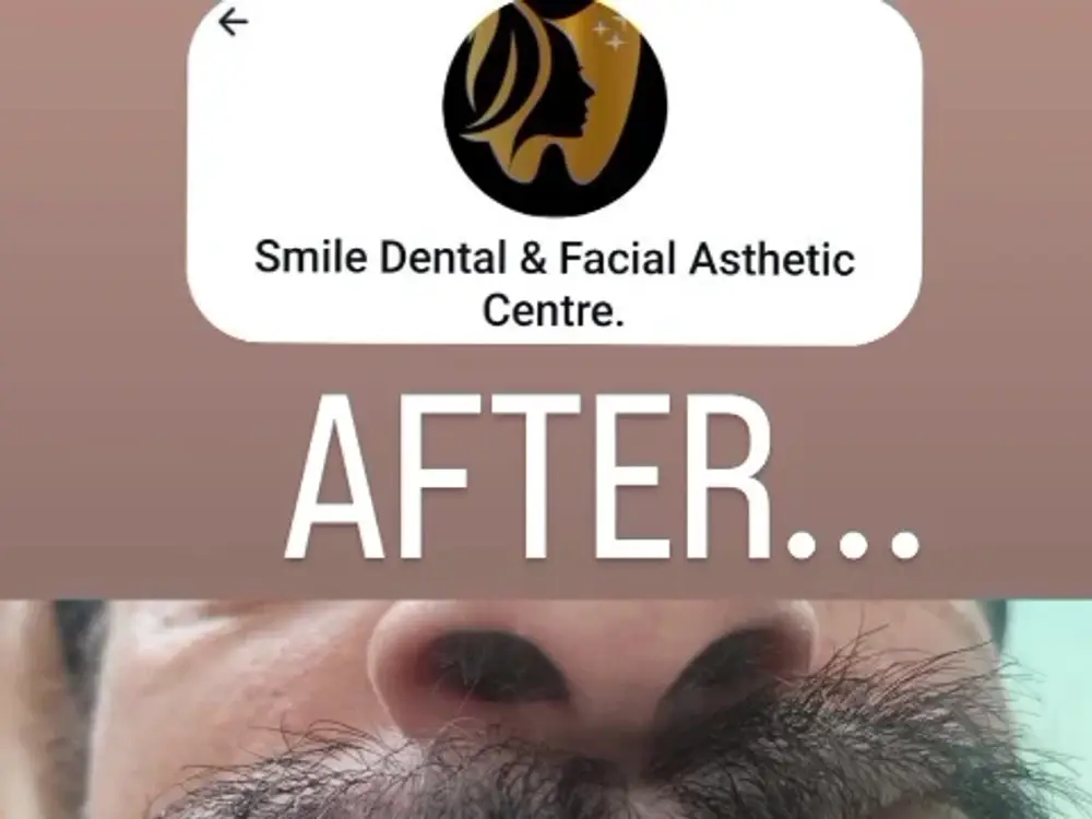 SMILE DENTAL & FACIAL AESTHETIC CENTRE, Subhash Nagar, Delhi