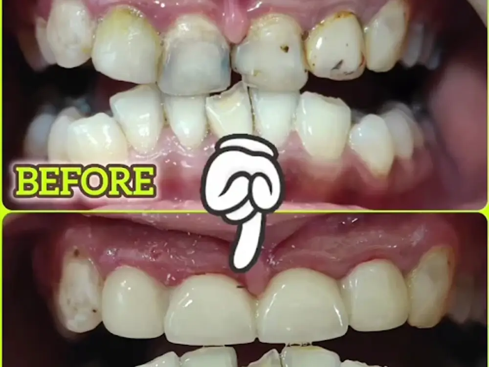 St. Mother Teresa Dental and Cosmetic Clinic, Kandivali West, Mumbai