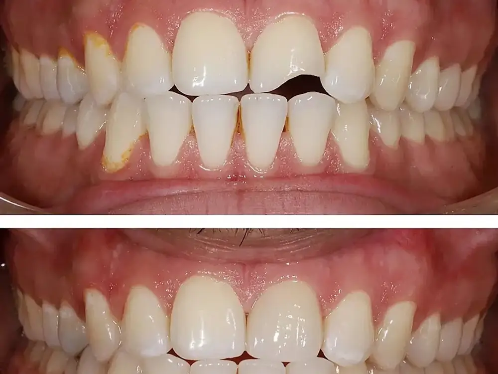 Teeth Care Centre, Satellite, Ahmedabad