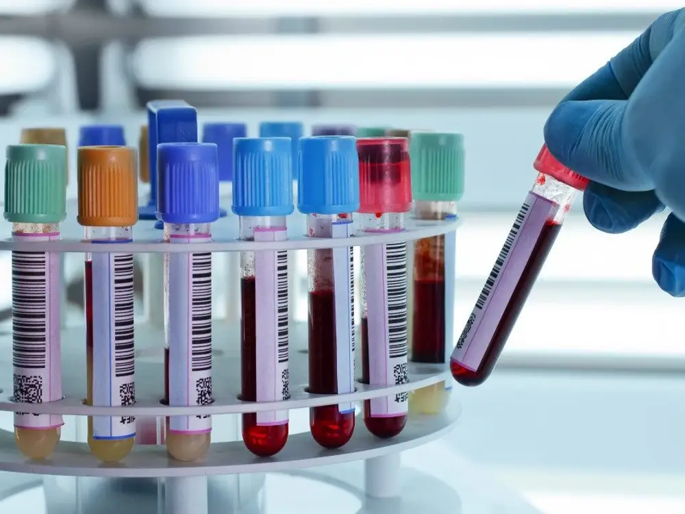 Thyrocare Diagnostic Lab, Goregaon West, Mumbai