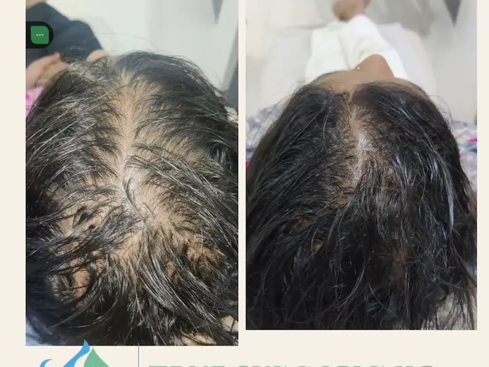 True skinn Clinic, Wakad, Pune