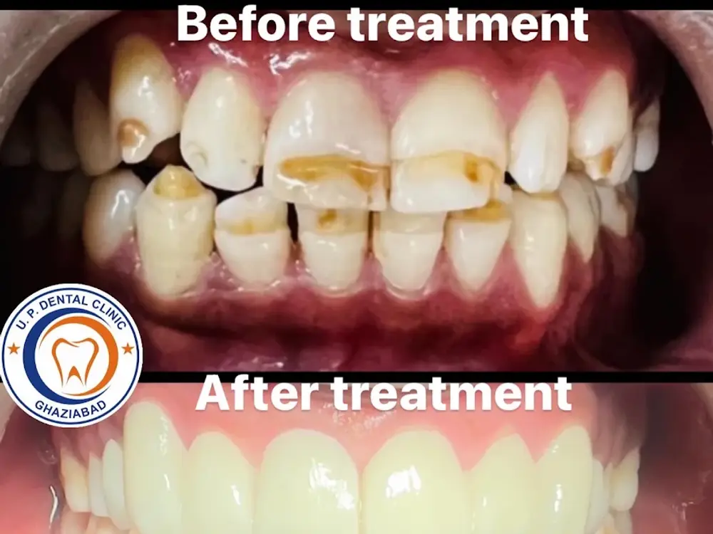 U.P. Dental Clinic, Naya Ganj, Ghaziabad