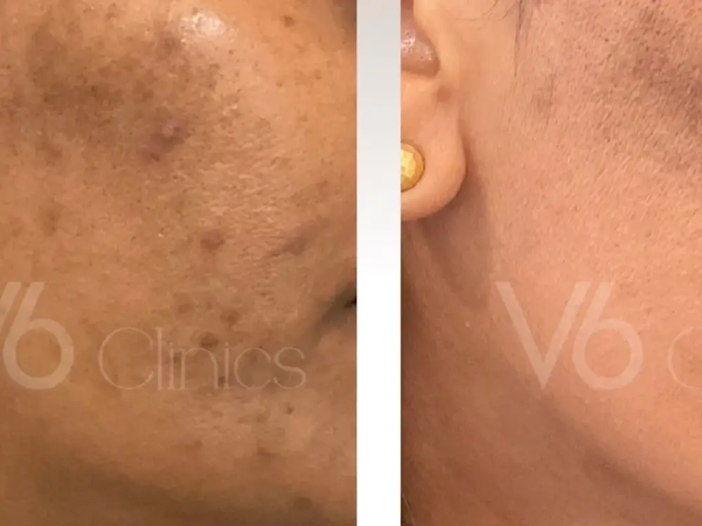 V6 Clinics, Galleria, Sector 28, Gurgaon