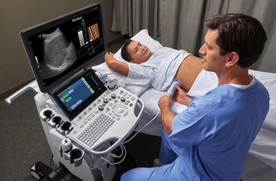Why should you consider undergoing Fibroscan?