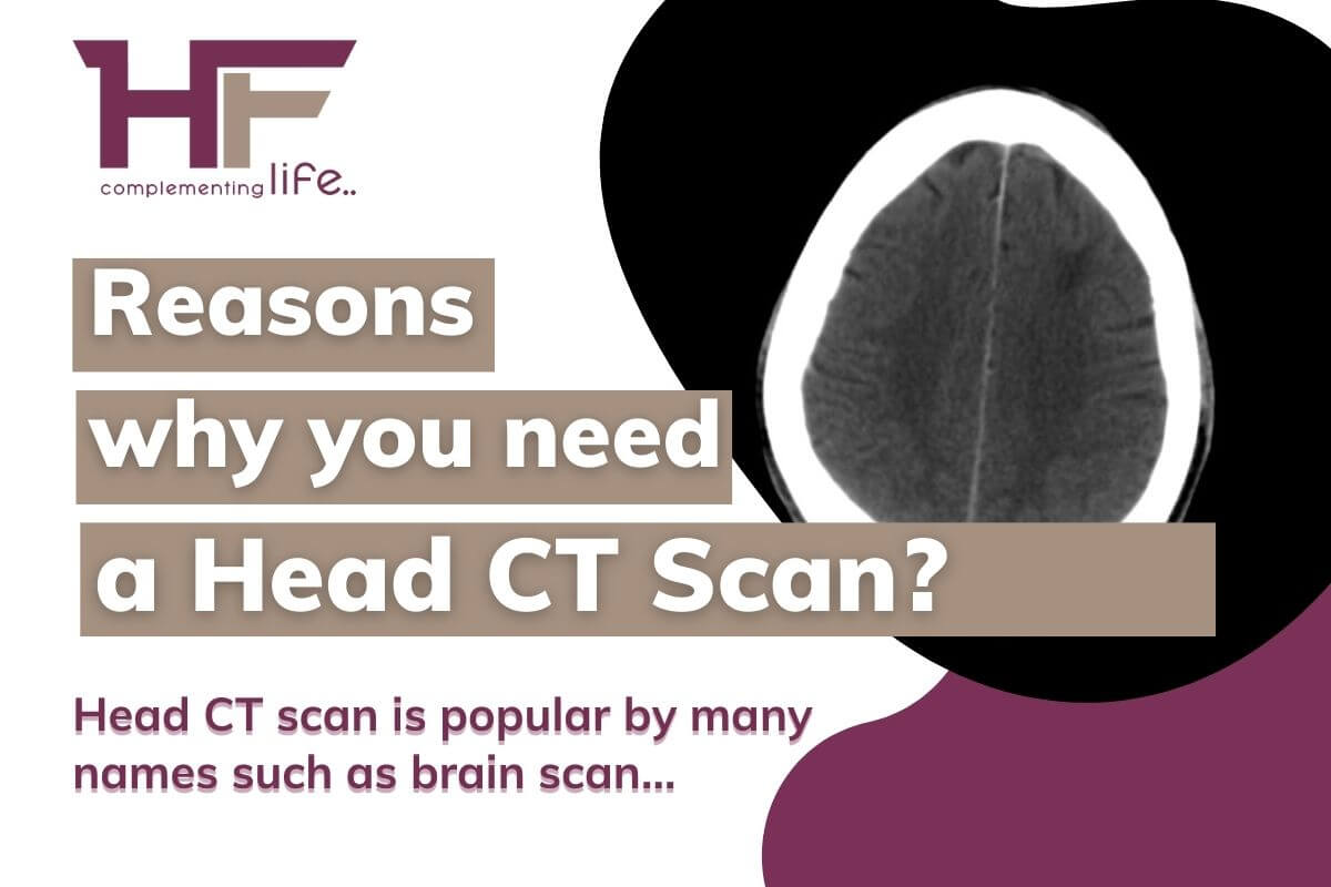 Reasons why you need a Head CT scan?