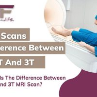 1.5T MRI  vs 3T MRI – What is the Difference?
