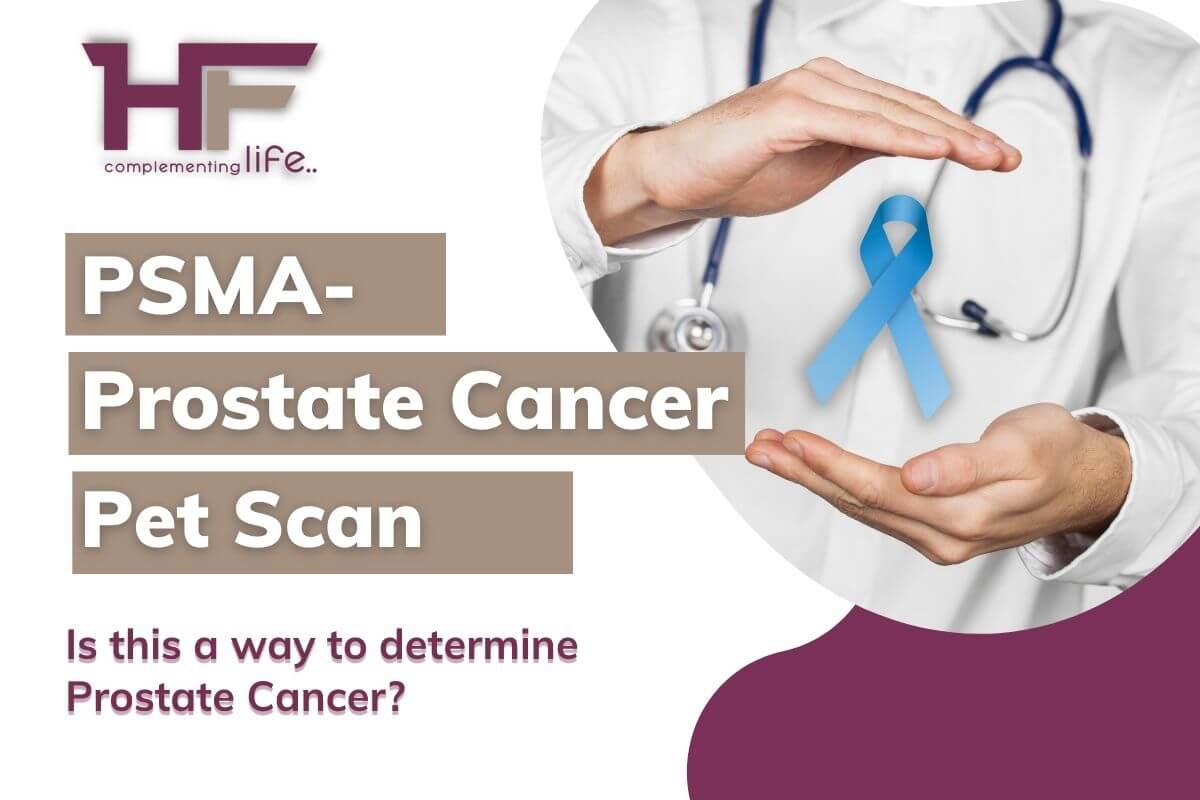 PSMA PET Scan- Is this a way to determine Prostate Cancer?