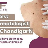 5 Best Dermatologists in Chandigarh