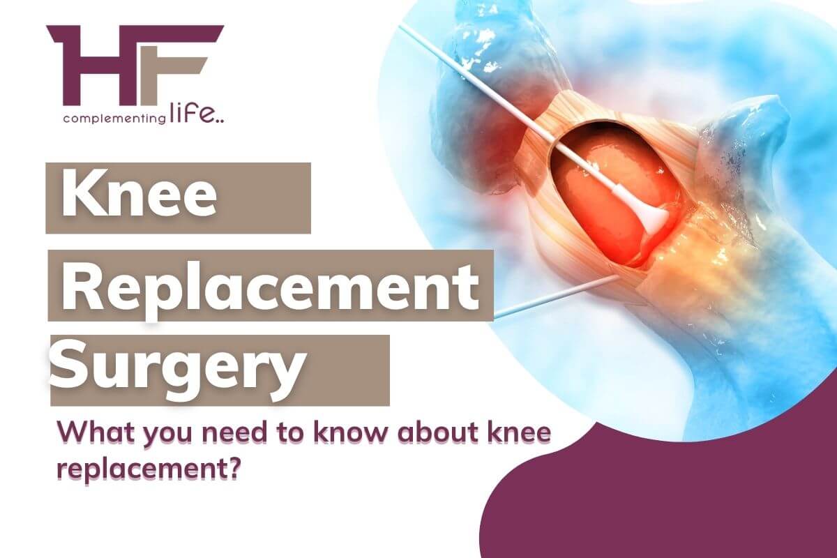 What to Expect After Knee Replacement Surgery – Everything You Need To Know