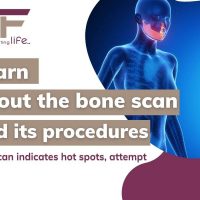 Learn about the Bone Scan and its procedures